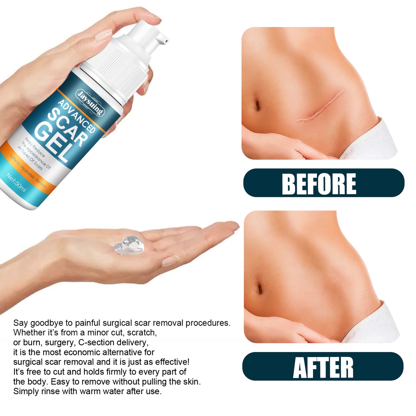 Advanced Scar Reduction Gel