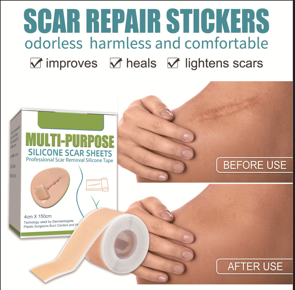 Medical Grade Silicone Scar Sheets/Tape (1.6”x 60”), for Post-Surgery Scars