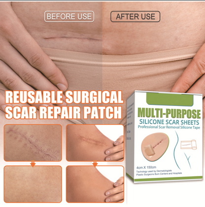 Medical Grade Silicone Scar Sheets/Tape (1.6”x 60”), for Post-Surgery Scars